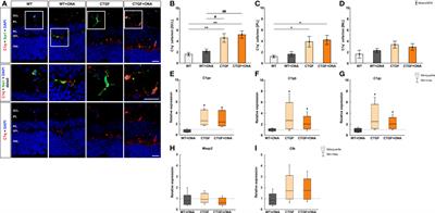 In a novel autoimmune and high-pressure glaucoma model a complex immune response is induced